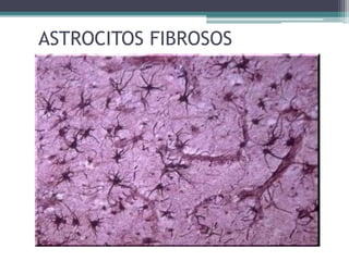 ASTROCITOS FIBROSOS
 
