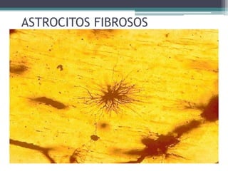 ASTROCITOS FIBROSOS
 