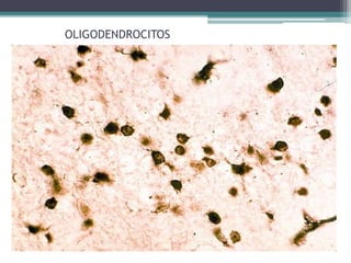 OLIGODENDROCITOS
 