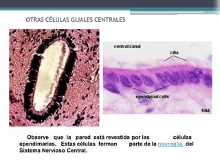Observe que la pared está revestida por las células
ependimarias. Estas células forman parte de la neuroglia del
Sistema Nervioso Central.
OTRAS CÉLULAS GLIALES CENTRALES
 