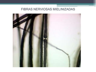 FIBRAS NERVIOSAS MIELINIZADAS
 