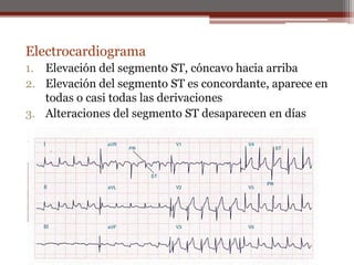 Electrocardiograma
1. Elevación del segmento ST, cóncavo hacia arriba
2. Elevación del segmento ST es concordante, aparece en
todas o casi todas las derivaciones
3. Alteraciones del segmento ST desaparecen en días
 
