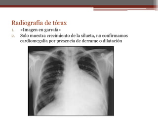 Radiografía de tórax
1. «Imagen en garrafa»
2. Solo muestra crecimiento de la silueta, no confirmamos
cardiomegalia por presencia de derrame o dilatación
 