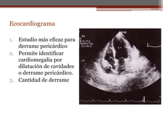 Ecocardiograma
1. Estudio más eficaz para
derrame pericárdico
2. Permite identificar
cardiomegalia por
dilatación de cavidades
o derrame pericárdico.
3. Cantidad de derrame
 