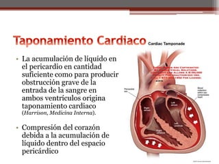 • La acumulación de líquido en
el pericardio en cantidad
suficiente como para producir
obstrucción grave de la
entrada de la sangre en
ambos ventrículos origina
taponamiento cardiaco
(Harrison, Medicina Interna).
• Compresión del corazón
debida a la acumulación de
líquido dentro del espacio
pericárdico
 