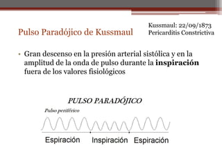 Pulso Paradójico de Kussmaul
• Gran descenso en la presión arterial sistólica y en la
amplitud de la onda de pulso durante la inspiración
fuera de los valores fisiológicos
Kussmaul: 22/09/1873
Pericarditis Constrictiva
 