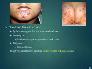  Skin & soft tissue infections
 By later serotypes. Common in small children.
 Impetigo –
 Small papules, vesicles, pustules → thick crusts
 Ecthyma –
 Ulcerated lesion
(staphylococcal lesions produce larger vesicles & bullous ulcers.)
28
 