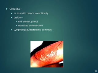  Cellulitis –
 In skin with breach in continuity.
 Lesion –
 Red, swollen, painful
 Not raised or demarcated.
 Lymphangitis, bacteremia common.
30
 