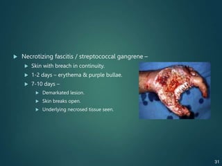  Necrotizing fascitis / streptococcal gangrene –
 Skin with breach in continuity.
 1-2 days – erythema & purple bullae.
 7-10 days –
 Demarkated lesion.
 Skin breaks open.
 Underlying necrosed tissue seen.
31
 