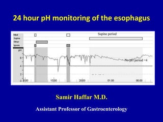 24 hour pH monitoring of the esophagus
Samir Haffar M.D.
Assistant Professor of Gastroenterology
 