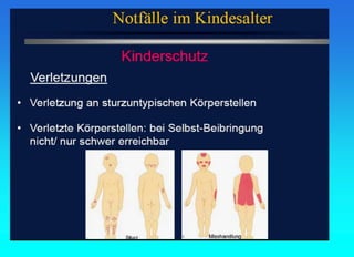 Fall Schema 24 Pädiatrische Notfälle.Notfallschema und Kruppsyndrom | PPT