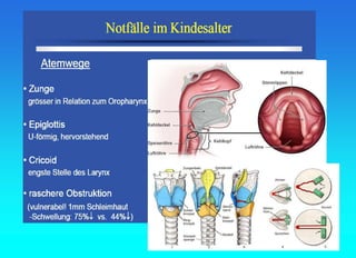 Fall Schema 24 Pädiatrische Notfälle.Notfallschema und Kruppsyndrom | PPT