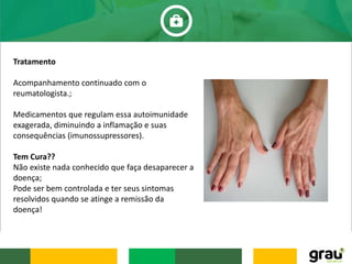 Tratamento
Acompanhamento continuado com o
reumatologista.;
Medicamentos que regulam essa autoimunidade
exagerada, diminuindo a inflamação e suas
consequências (imunossupressores).
Tem Cura??
Não existe nada conhecido que faça desaparecer a
doença;
Pode ser bem controlada e ter seus sintomas
resolvidos quando se atinge a remissão da
doença!
 