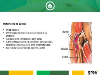 Tratamento da bursite
• Imobilização;
• Diminuição completa do esforço no local
afetado;
• Aplicação de compressas com gelo;
• Administração de medicamentos (analgésicos,
relaxantes musculares e anti-inflamatórios);
• Exercícios fisioterápicos podem ajudar.
 