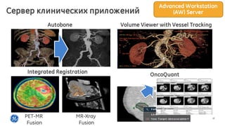 10
Autobone Volume Viewer with Vessel Tracking
PET-MR
Fusion
MR-Xray
Fusion
Integrated Registration OncoQuant
Сервер клинических приложений
Advanced Workstation
(AW) Server
 