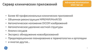 11
• Более 40 професиональных клинических приложений
• Объемная реконструкция MPR/MIP/MinIP/3D
• Автоматическое наложение DICOM изображений
• Автоматическое удаление костной структуры
• Анализ сосудов
• Экспресс обнаружение новообразований
• Предоперационное планирование в тарвматологии и ортопедии
• и многое другое...
Сервер клинических приложений
Advanced Workstation
(AW) Server
 