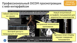 8
Профессиональный DICOM просмотровщик
c web-интерфейсом
Новый интуитивный
интерфейс пользователя для
радиологов и клиницистов
Гибкий навигатор
по сериям
Встроенное клиническое
приложение
Быстрый доступ к
предыдущим исследованиям
Протокол Smart Display
изучает поведение
пользователя
Universal
Viewer (UV)
 