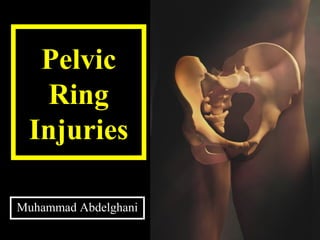 Pelvic
Ring
Injuries
Muhammad Abdelghani
 