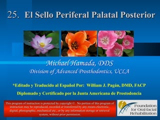 25. El Sello Periferal Palatal Posterior

Michael Hamada, DDS
Division of Advanced Prosthodontics, UCLA
*Editado y Traducido al Español Por: William J. Pagán, DMD, FACP
Diplomado y Certificado por la Junta Americana de Prostodoncia
This program of instruction is protected by copyright ©. No portion of this program of
instruction may be reproduced, recorded or transferred by any means electronic,
digital, photographic, mechanical etc., or by any information storage or retrieval
system, without prior permission.

 