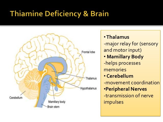 case studies of transient epileptic amnesia
