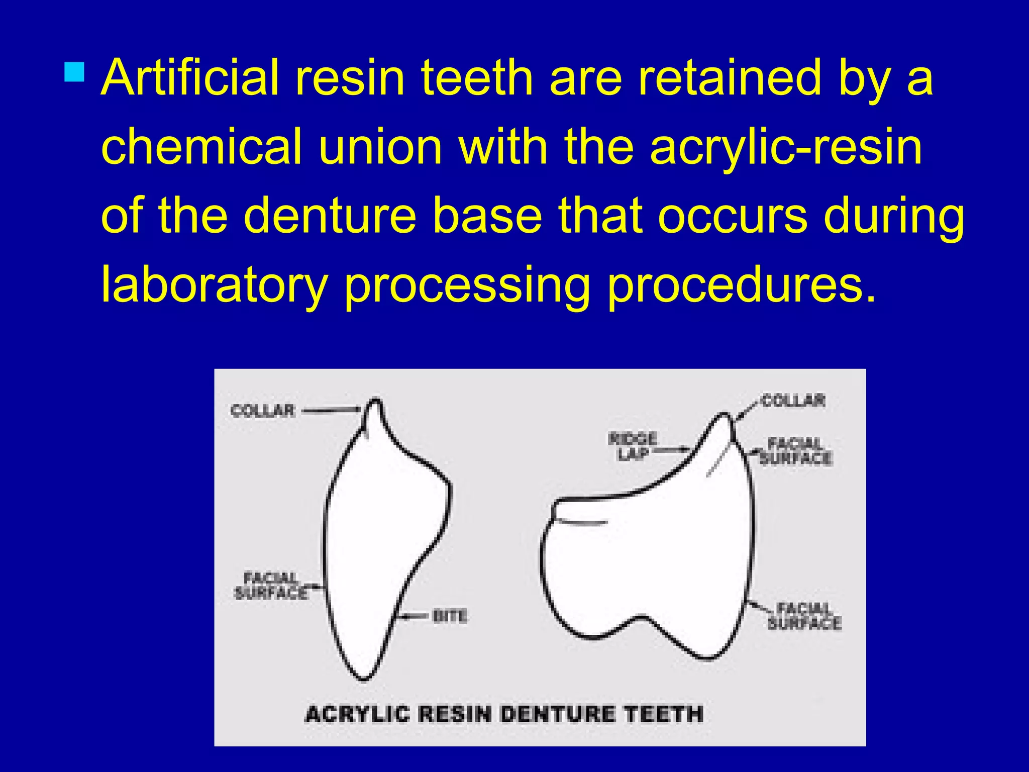  Artificial resin teeth are retained by a
chemical union with the acrylic-resin
of the denture base that occurs during
laboratory processing procedures.
 