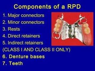 25. rpd denture bases+teeth | PPT