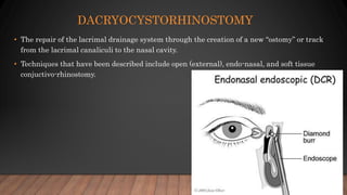 DACRYOCYSTORHINOSTOMY
• The repair of the lacrimal drainage system through the creation of a new “ostomy” or track
from the lacrimal canaliculi to the nasal cavity.
• Techniques that have been described include open (external), endo-nasal, and soft tissue
conjuctivo-rhinostomy.
 