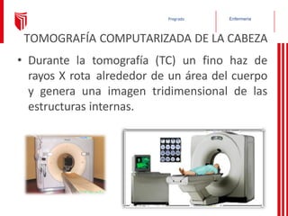 Enfermería
Pregrado
TOMOGRAFÍA COMPUTARIZADA DE LA CABEZA
• Durante la tomografía (TC) un fino haz de
rayos X rota alrededor de un área del cuerpo
y genera una imagen tridimensional de las
estructuras internas.
 