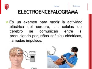 Enfermería
Pregrado
ELECTROENCEFALOGRAMA
⦿ Es un examen para medir la actividad
eléctrica
cerebro
del cerebro, las
se comunican
células del
entre sí
produciendo pequeñas señales eléctricas,
llamadas impulsos.
 