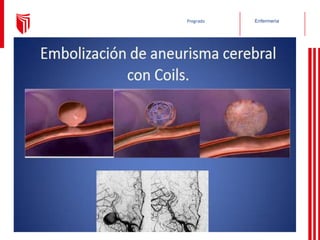 Enfermería
Pregrado
 