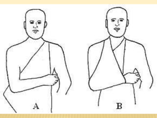 Tipos de vendaje ,definiciones etc......