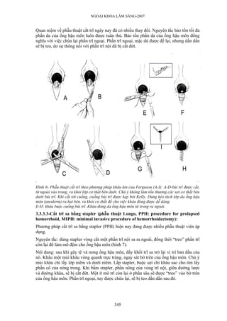 NGOẠI KHOA LÂM SÀNG-2007


Quan niệm về phẫu thuật cắt trĩ ngày nay đã có nhiều thay đổi. Nguyên tắc bảo tồn tối đa
phần da của ống hậu môn luôn được tuân thủ. Bảo tồn phần da của ống hậu môn đồng
nghĩa với việc chừa lại phần trĩ ngoại. Phần trĩ ngoại, mặc dù được để lại, nhưng dần dần
sẽ bị teo, do sự thông nối với phần trĩ nội đã bị cắt đứt.




Hình 6- Phẫu thuật cắt trĩ theo phương pháp khâu kín của Ferguson (A-I): A-D-búi trĩ được cắt,
từ ngoài vào trong, ra khỏi lớp cơ thắt bên dưới. Chú ý không làm tổn thương các sợi cơ thắt bên
dưới búi trĩ. Khi cắt tới cuống, cuống búi trĩ được kẹp bởi Kelly. Dùng kéo tách lớp da ống hậu
môn (anoderm) ra hai bên, ra khỏi cơ thắt để cho việc khâu đóng được dễ dàng.
E-H: khâu buộc cuống búi trĩ. Khâu đóng da ống hậu môn từ trong ra ngoài.
3.3.3.3-Cắt trĩ sa bằng stapler (phẫu thuật Longo, PPH: procedure for prolapsed
hemorrhoid, MIPH: minimal invasive procedure of hemorrhoidectomy):
Phương pháp cắt trĩ sa bằng stapler (PPH) hiện nay đang được nhiều phẫu thuật viên áp
dụng.
Nguyên tắc: dùng stapler vòng cắt một phần trĩ nội sa ra ngoài, đồng thời “treo” phần trĩ
còn lại để làm mô đệm cho ống hậu môn (hình 7).
Nội dung: sau khi gây tê và nong ống hậu môn, đẩy khối trĩ sa trở lại vị trí ban đầu của
nó. Khâu một mủi khâu vòng quanh trực tràng, ngay sát bờ trên của ống hậu môn. Chú ý
mủi khâu chỉ lấy lớp niêm và dưới niêm. Lắp stapler, buộc sợi chỉ khâu sao cho ôm lấy
phần cổ của nòng trong. Khi bấm stapler, phần nông của vòng trĩ nội, giữa đường lược
và đường khâu, sẽ bị cắt đứt. Một ít mô trĩ còn lại ở phần sâu sẽ được “treo” vào bờ trên
của ống hậu môn. Phần trĩ ngoại, tuy được chừa lại, sẽ bị teo dần dần sau đó.




                                             345
 