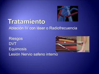 Ablación IV con láser o Radiofrecuencia Riesgos DVT Equimosis Lesión Nervio safeno interno 