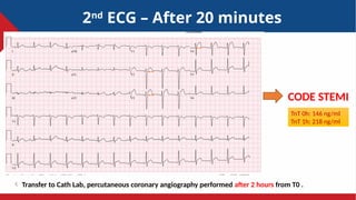 250704 STEMI in young patienyyyyyyt.pptx