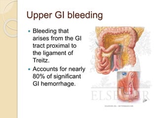Upper GI bleeding
 Bleeding that
arises from the GI
tract proximal to
the ligament of
Treitz.
 Accounts for nearly
80% of significant
GI hemorrhage.
 