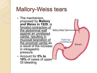 Mallory-Weiss tears
 The mechanism,
proposed by Mallory
and Weiss in 1929, is
forceful contraction of
the abdominal wall
against an unrelaxed
cardia, resulting in
mucosal laceration of
the proximal cardia as
a result of the increase
in intragastric
pressure.
 Account for 5% to
10% of cases of upper
GI bleeding
 