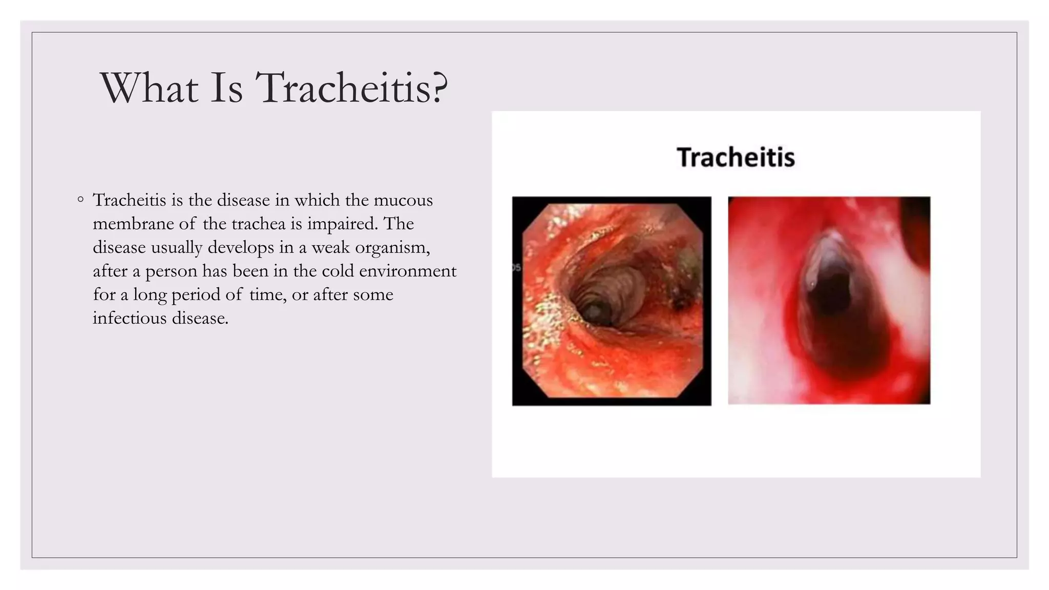 What Is Tracheitis?
◦ Tracheitis is the disease in which the mucous
membrane of the trachea is impaired. The
disease usually develops in a weak organism,
after a person has been in the cold environment
for a long period of time, or after some
infectious disease.
 