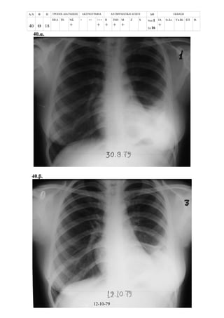 Α/Α Φ Η ΤΡΟΠΟΣ ΔΙΑΓΝΩΣΗΣ ΑΚΤΙΝΟΓΡΑΦΙΑ ΑΝΤΙΦΥΜΑΤΙΚΗ ΑΓΩΓΗ ΔΘ ΕΚΒΑΣΗ
40 Θ 18
ΠΕΛ ΤΕ ΝΣ
+
+ ++ +++
+
R
+
ΙΝΗ
+
Μ
+
Z S Νοσ.1
Σπ.16
ΙΑ
+
Ιν.Στ. Υπ.Βλ ΕΠ Θ.
40.α.
40.β.
12-10-79
 