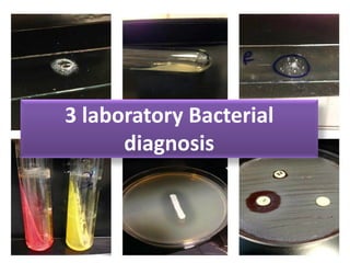 3 laboratory Bacterial
diagnosis
 