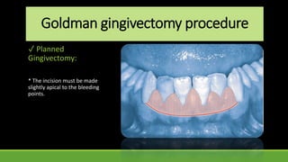 Goldman gingivectomy procedure
✓ Planned
Gingivectomy:
* The incision must be made
slightly apical to the bleeding
points.
 