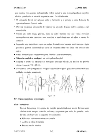 OSTENSIVO CAAML 1206
OSTENSIVO ORIGINAL
3-7
esta técnica, pois, quando mal realizada, poderá induzir a uma eventual perda do membro
afetado, quando não se tratar de amputação total. Os cuidados são:
• O torniquete deverá ser aplicado entre o ferimento e o coração a uma distância de
aproximadamente 5 cm da lesão.
• Deve-se posicionar um pacote de curativo ou um rolo de pano sobre a artéria a ser
comprimida.
• Utilize um cinto longo, gravata, meia ou outro material que não venha provocar
estrangulamento dos membros, para envolver o local dando um nó sobre o pacote de
curativo.
• Improvise uma haste firme, como um pedaço de madeira ou barra de metal (canetas e lápis
podem se quebrar facilmente) que deve ser colocada sobre o nó onde será aplicado um
outro.
• Gire a haste até que o sangramento pare, fixando-a convenientemente.
• Não solte ou alivie o torniquete até a chegada ao hospital.
• Registre o horário de aplicação do torniquete em local visível., se possível na própria
vítima (exemplo: TQ – 13:20).
• Não cubra o torniquete para que não passe despercebido pelos que darão continuidade aos
cuidados prestados ao paciente.
Figura 3.4
3.9 - Tipos especiais de hemorragias
3.9.1 - Hemoptise
Tipo de hemorragia proveniente do pulmão, caracterizada por acesso de tosse com
eliminação de sangue vermelho rutilante e espumoso por meio de golfadas, onde
deverão ser observados os seguintes procedimentos:
• Coloque a vítima em repouso e recostada
• Acalme-a; não a deixe falar
• Procure auxílio médico
 