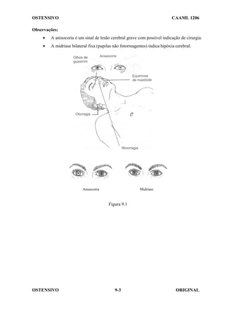 OSTENSIVO CAAML 1206
OSTENSIVO ORIGINAL
9-3
Observações:
• A anisocoria é um sinal de lesão cerebral grave com possível indicação de cirurgia.
• A midríase bilateral fixa (pupilas não fotorreagentes) indica hipóxia cerebral.
Anisocoria Midríase
Figura 9.1
 