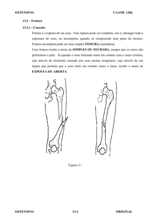 OSTENSIVO CAAML 1206
OSTENSIVO ORIGINAL
13-2
13.2 – Fratura
13.2.1 - Conceito
Fratura é a ruptura de um osso. Esta ruptura pode ser completa, isto é, abranger toda a
espessura do osso, ou incompleta, quando só compreende uma parte do mesmo.
Fratura incompleta pode ser uma simples FISSURA (rachadura).
Uma fratura recebe o nome de SIMPLES OU FECHADA, sempre que os ossos não
perfurarem a pele. Já quando o osso fraturado entra em contato com o meio externo,
seja através do ferimento causado por suas arestas irregulares, seja através de um
trajeto que permita que o osso entre em contato como o meio, recebe o nome de
EXPOSTA OU ABERTA.
Figura 13.1
 