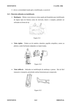 OSTENSIVO CAAML 1206
OSTENSIVO ORIGINAL
14-2
• elevar a extremidade lesada após a imobilização, se possível.
14.3 - Materiais utilizados na imobilização
• Bandagens – Muitas vezes torna-se a única opção pré-hospitalar para imobilização
de alguns tipos de fraturas como de clavícula, úmero e escápula, podendo ser
utilizadas na forma de tipóia.
Figura 14.1
• Talas rígidas – Podem ser de madeira, alumínio, papelão ortopédico, arame ou
plástico, sendo facilmente adaptadas ou improvisadas.
Figura 14.2
• Talas infláveis – Indicadas na imobilização de antebraço e pernas. São de fácil
manuseio e transporte, permitindo realizar hemostasia por compressão.
Figura 14.3
 