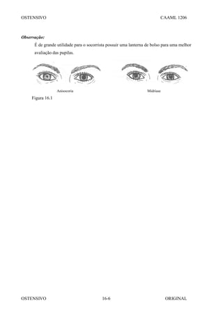OSTENSIVO CAAML 1206
OSTENSIVO ORIGINAL
16-6
Observação:
É de grande utilidade para o socorrista possuir uma lanterna de bolso para uma melhor
avaliação das pupilas.
Anisocoria Midríase
Figura 16.1
 