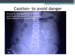 Caution- to avoid danger
Women of child-bearing age should be
questioned about possibility of pregnancy
before abdominal X-ray investigation
 