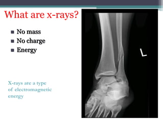 What are x-rays?
 No mass
 No charge
 Energy
X-rays are a type
of electromagnetic
energy
 