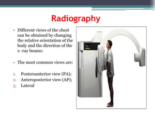 Radiography
• Different views of the chest
can be obtained by changing
the relative orientation of the
body and the direction of the
x -ray beams:
• The most common views are:
1. Posteroanterior view (PA);
2. Anteroposterior view (AP);
3. Lateral
 