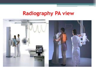 Radiography PA view
 