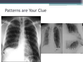 Patterns are Your Clue
 